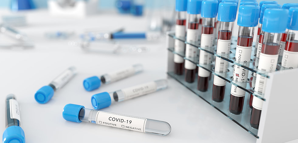 Testing for coronavirus Covid-19 in a lab. Medical screening and Covid tests production.